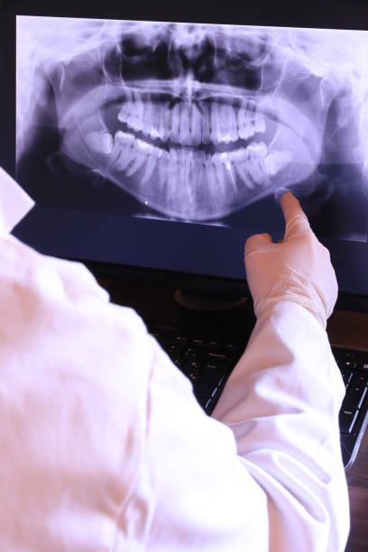 Best Emergency Dentist for Lost Fillings or Crowns in Sorrento, LA