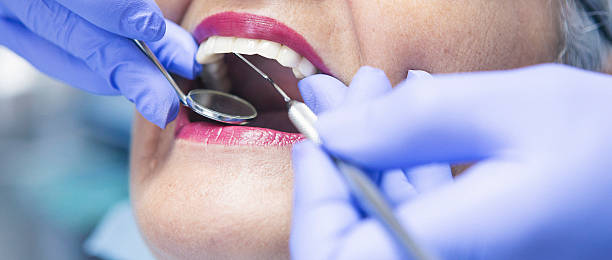 Best Broken or Cracked Tooth Emergency Dentist in Sorrento, LA
